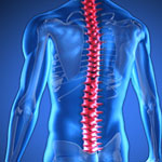 Spinal implant